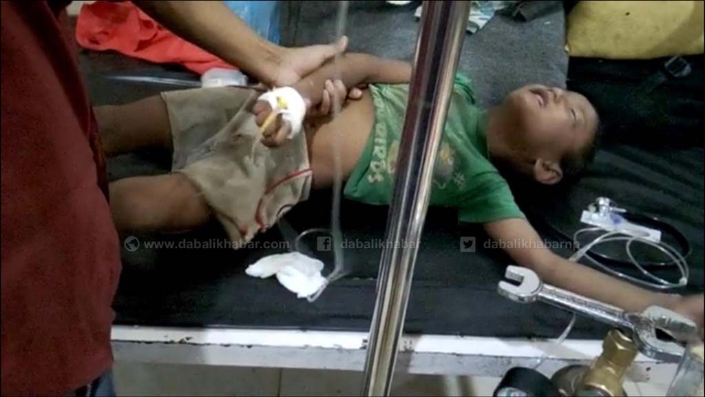 two child injury by high voltage electricity in nuwakot