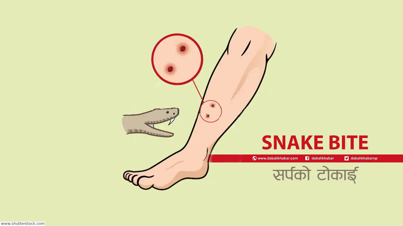 snake bite vector nepal