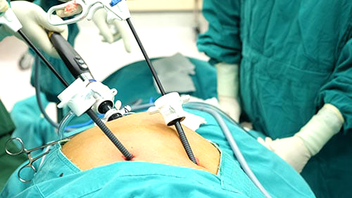 gallbladder surgery malpractice